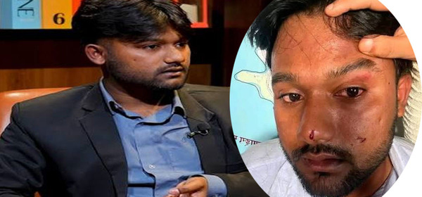 जेनजी अभियन्ता माजिद अन्सारी अस्पतालबाट डिस्चार्ज
